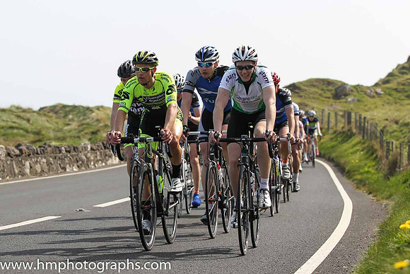 2014 Tour of the North  Stage 1 on the Antrim Coast Road